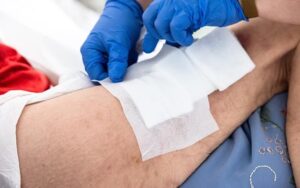 بیڈ سورز: بستر کے زخم- شفا نیوز