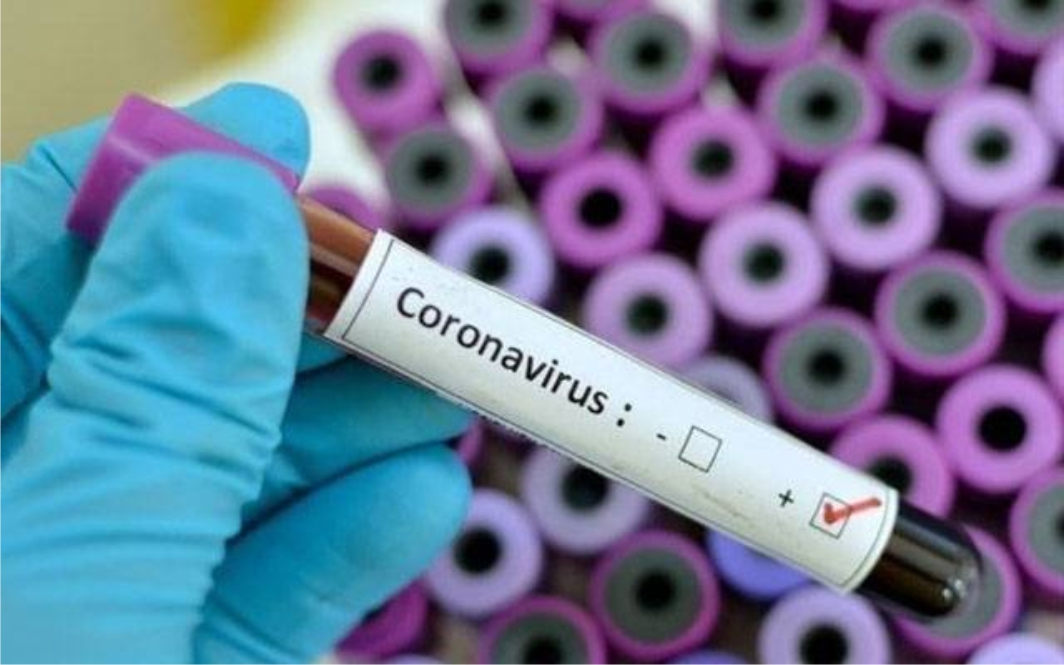 پاکستان میں کووڈ-19 کی نئی لہر، مثبت کیسز 17 فیصد- شفا نیوز