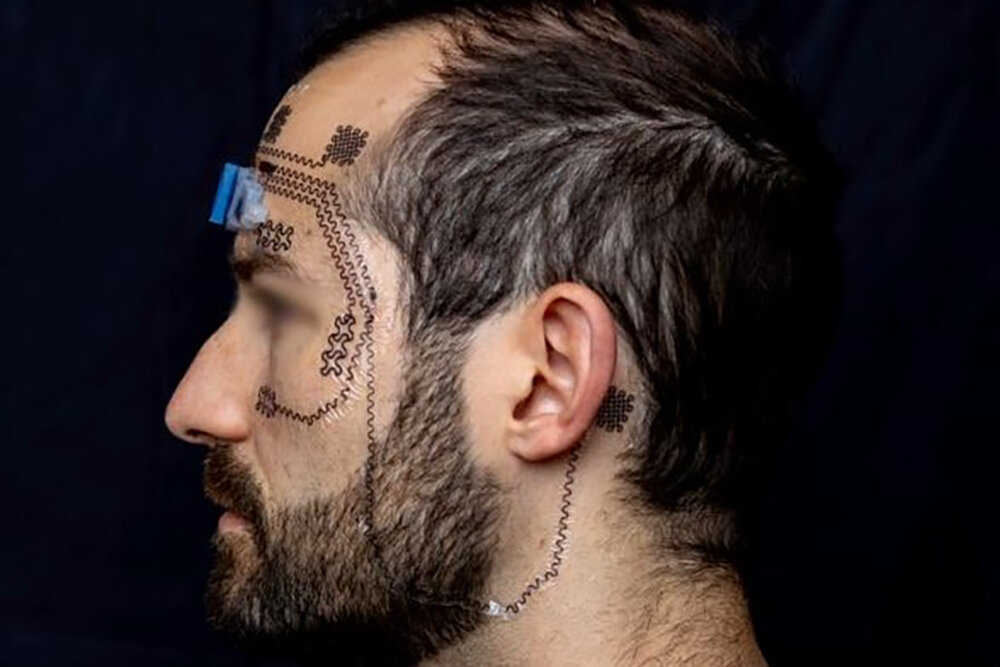 دماغی تھکن کی پیمائش کے لیے نیا ای ٹیٹو تیار- شفا نیوز