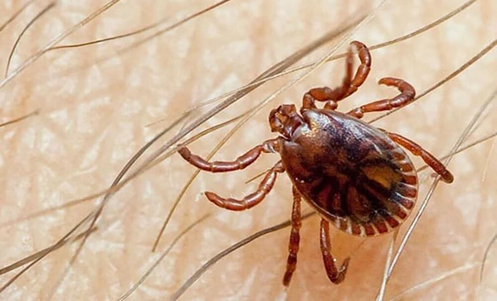 سندھ میں کانگو وائرس سے رواں سال کی پہلی موت رپورٹ- شفا نیوز