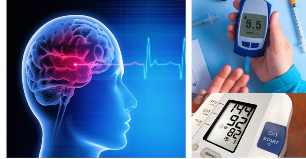 بلڈ پریشر اور شوگر: سٹروک کی شرح میں اضافے کا سبب- شفا نیوز