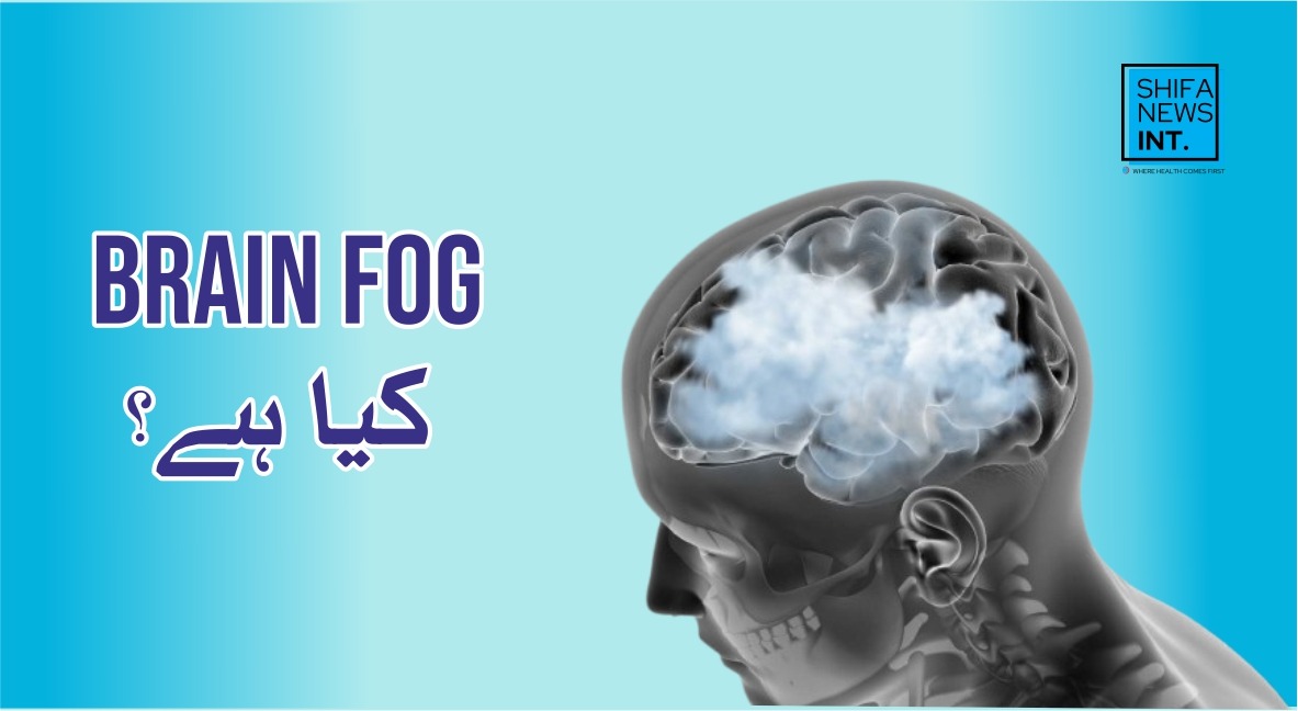 Brain Fog: What it is and why it happens