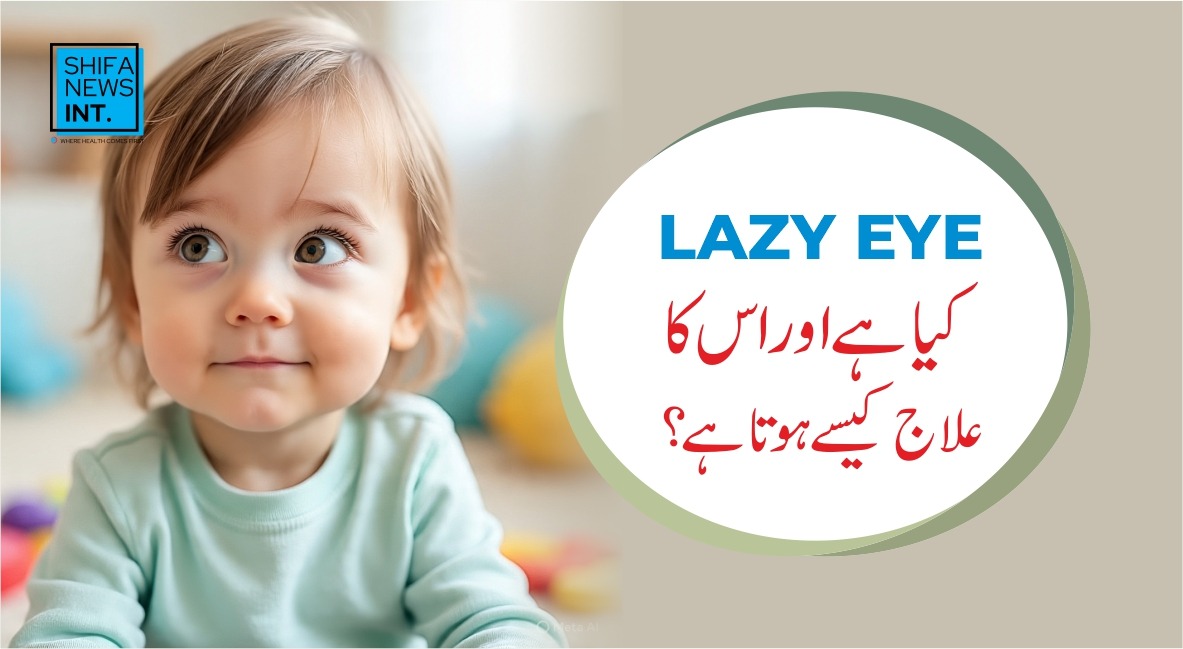 Lazy eye (Amblyopia) explained