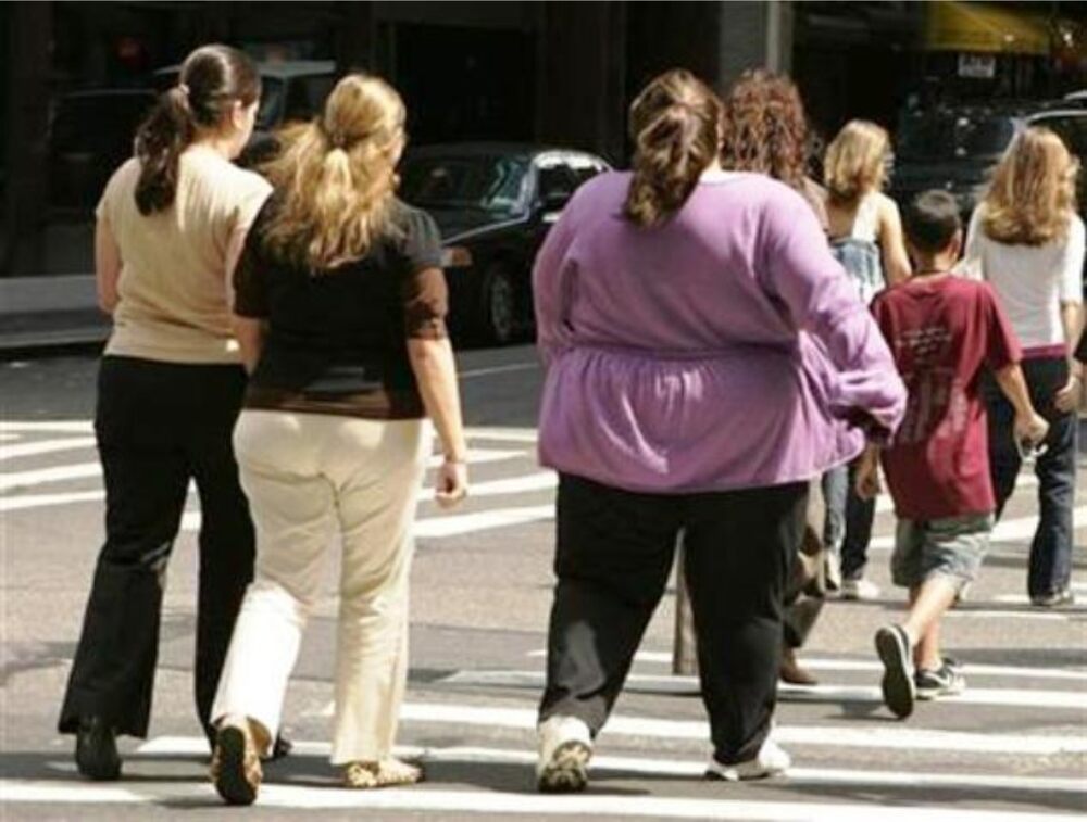 Some obese people jogging in a park as part of their efforts to reduce weight and improve health.
