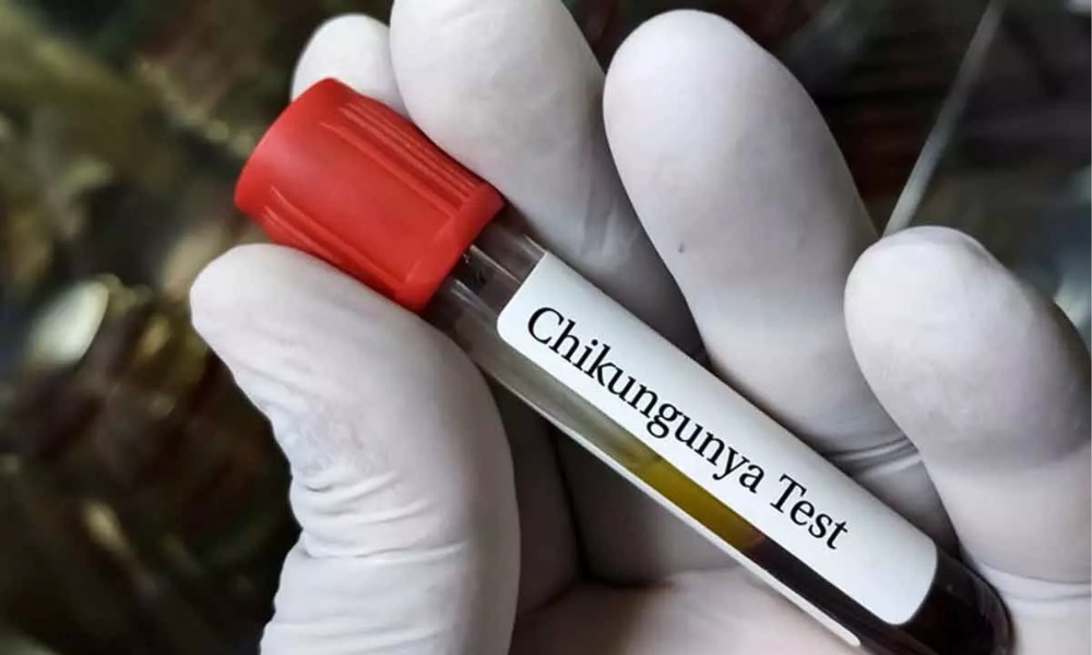A close-up view of a healthcare worker holding a blood sample for chikungunya testing