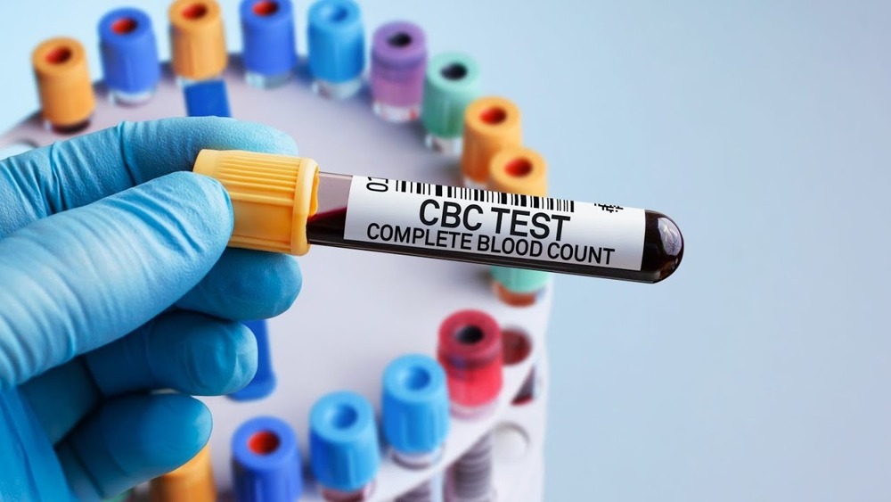 Test tube containing blood sample for Complete Blood Count (CBC) test in medical laboratory.