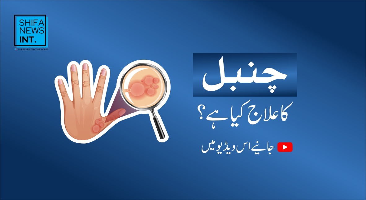 Understanding psoriasis: How it affects the skin and health