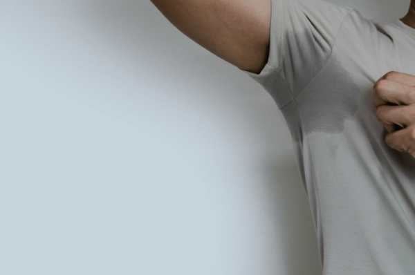 Abnormally Excessive Sweating (Hyperhidrosis)