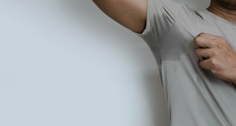 Abnormally Excessive Sweating (Hyperhidrosis)