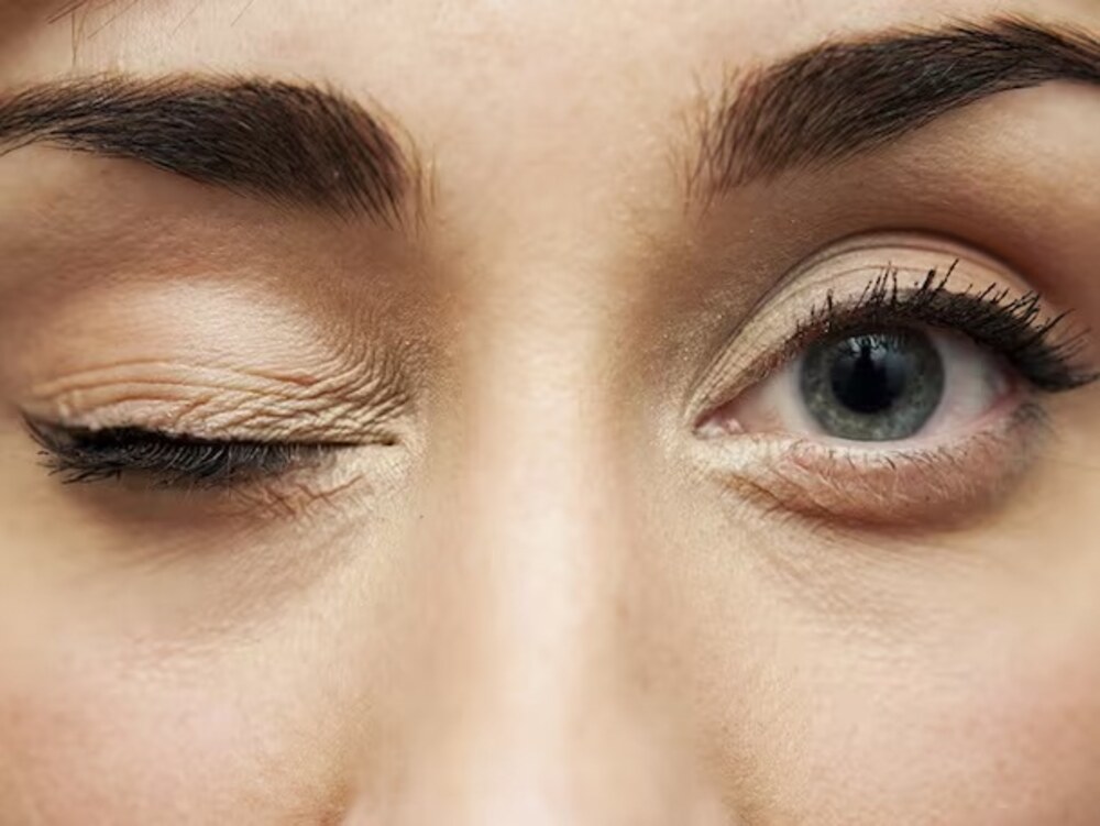 Close-up of a person’s eye with subtle upper eyelid twitch