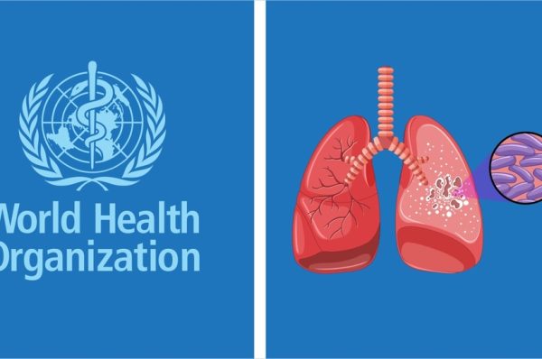 ٹی بی کیسز میں ریکارڈ اضافہ، اموات میں کمی: ڈبلیو ایچ او