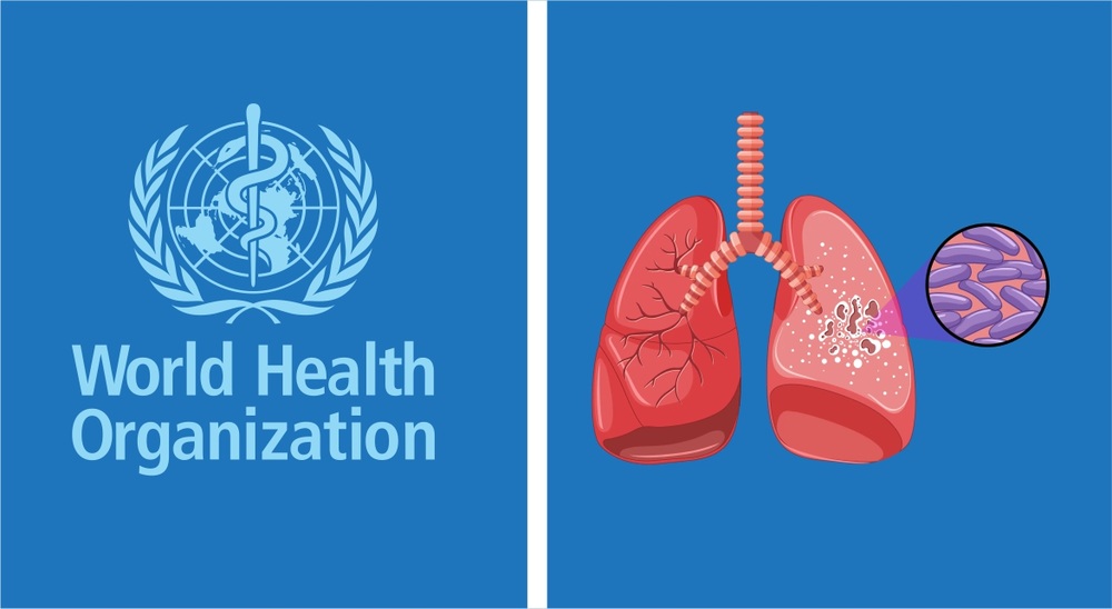 ٹی بی کیسز میں ریکارڈ اضافہ، اموات میں کمی: ڈبلیو ایچ او