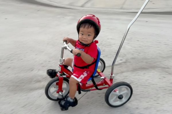 ہنٹر سنڈروم میں پہلی کامیاب جین تھیراپی، تین سالہ بچے کی حالت بہتر