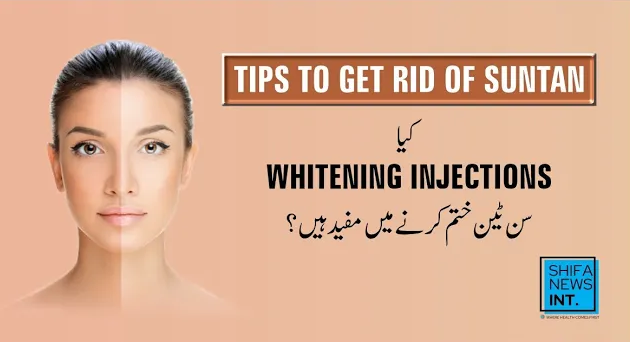 Tips to get rid of SUNTAN