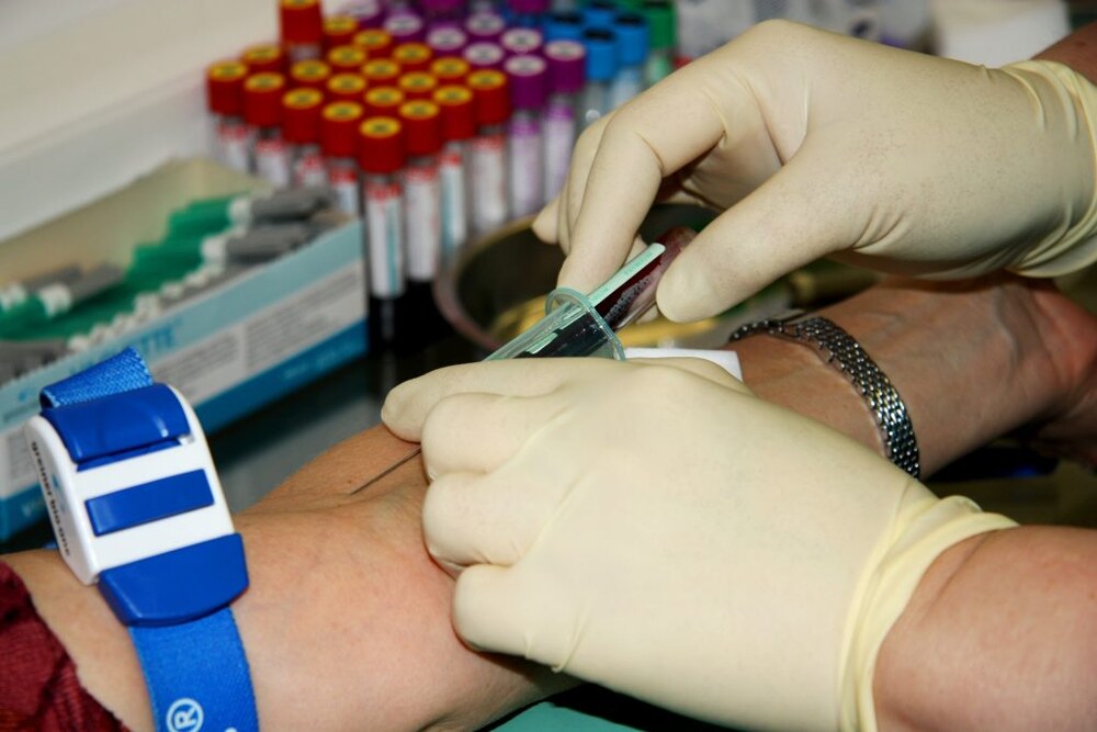 Myelofibrosis: When Bone Marrow Stops Making Blood