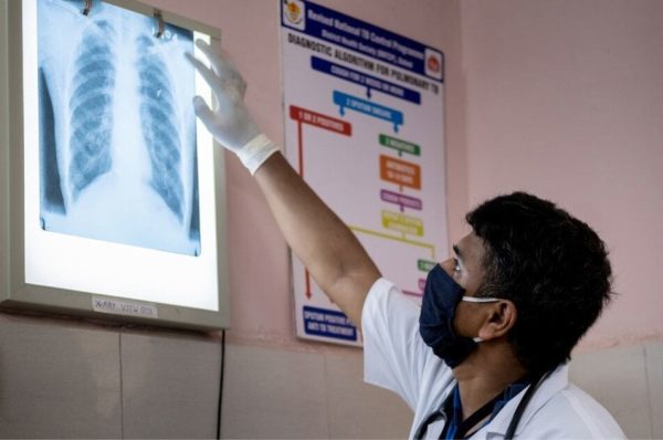 بلوچستان میں ٹی بی کیسز میں تشویشناک اضافہ