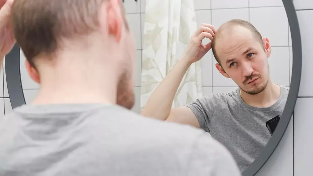 Alopecia: Causes and Care of Hair Fall