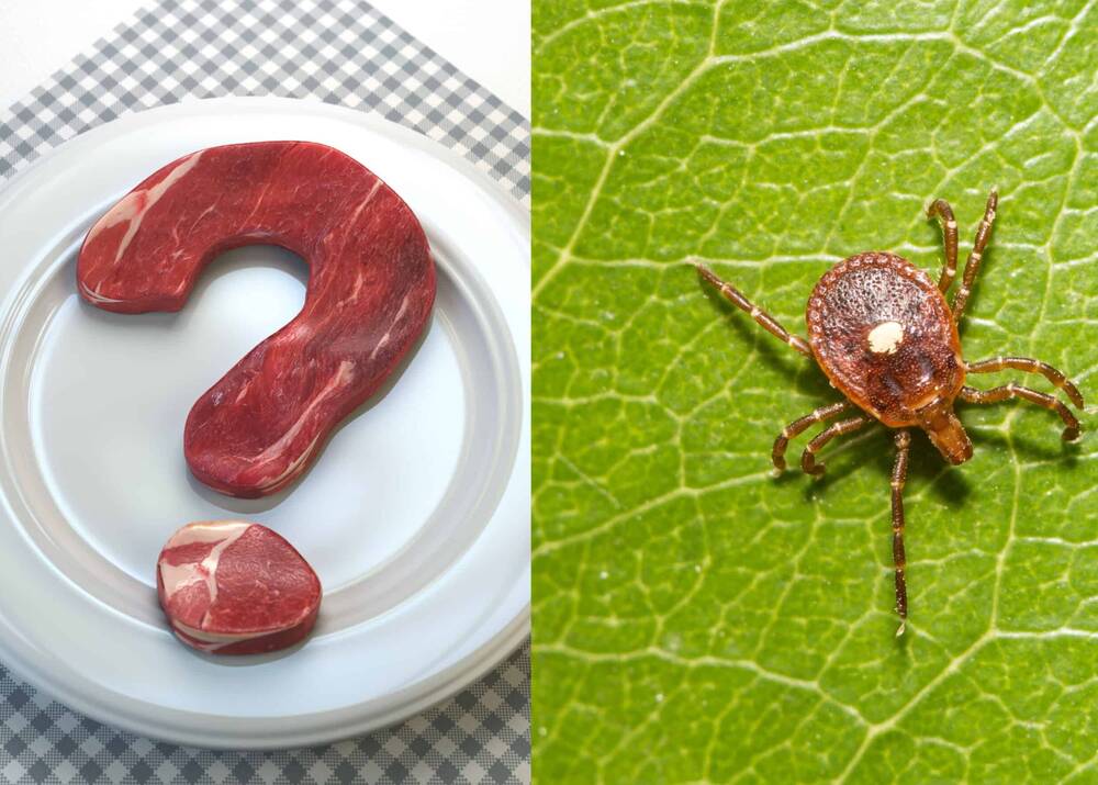Alpha-gal Syndrome: The Meat Allergy Triggered by Tick Bites