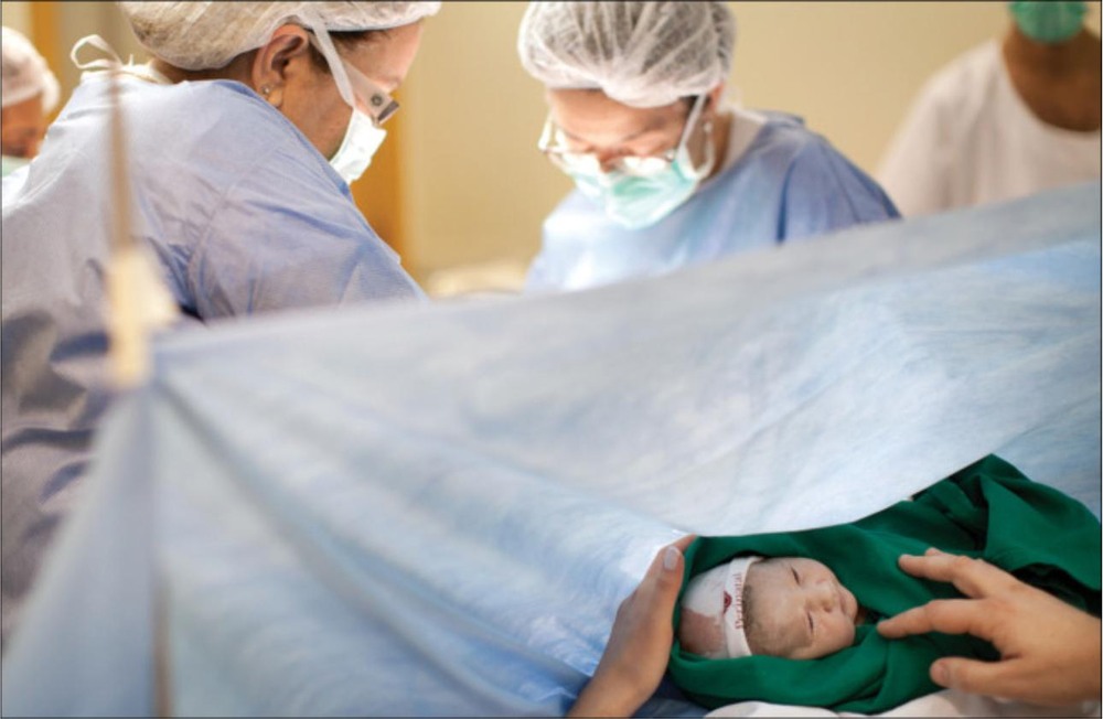Cesarean section surgery being performed in a hospital highlighting maternal care and childbirth safety