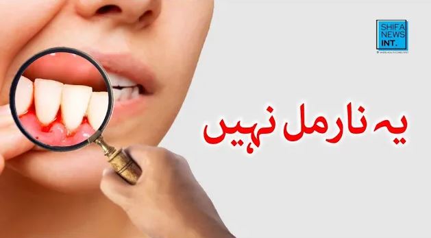 Stop ignoring bleeding gums | Common myths debunked