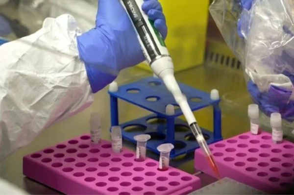 نپاہ وائرس سے پاکستان کو براہ راست خطرہ نہیں، ماہرین