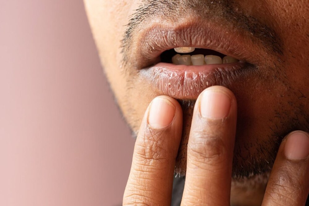 زیروسٹومیا: منہ خشک کیوں؟