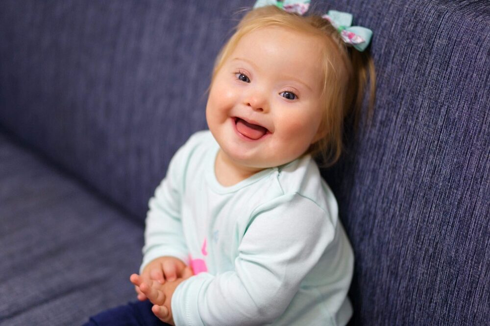 Smiling baby with Down syndrome showing warmth and innocence, representing genetic diversity and inclusive care