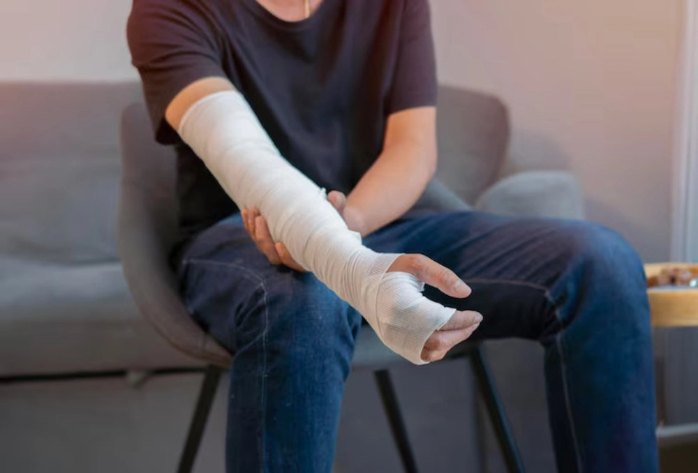 Bone fracture showing a broken bone, swelling, severe pain, trauma, orthopedic injury, diagnosis, X-ray, treatment, surgery, and rehabilitation
