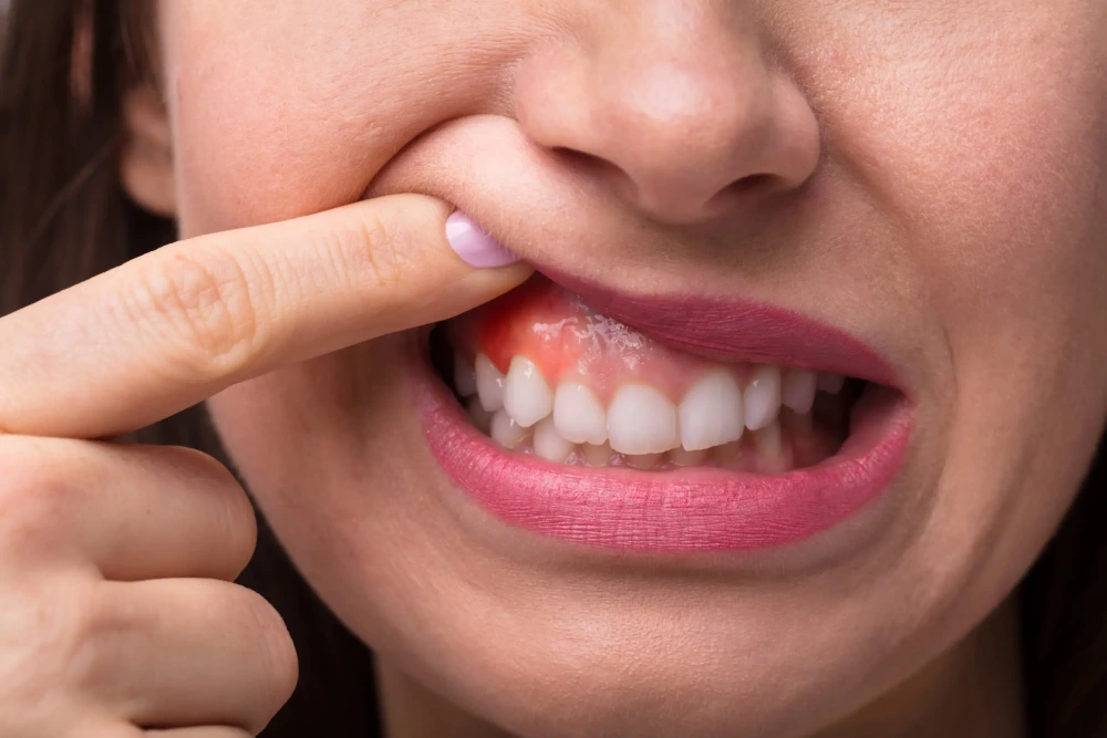 Tooth abscess symptoms, dental infection, diagnosis, treatment, and oral health illustration