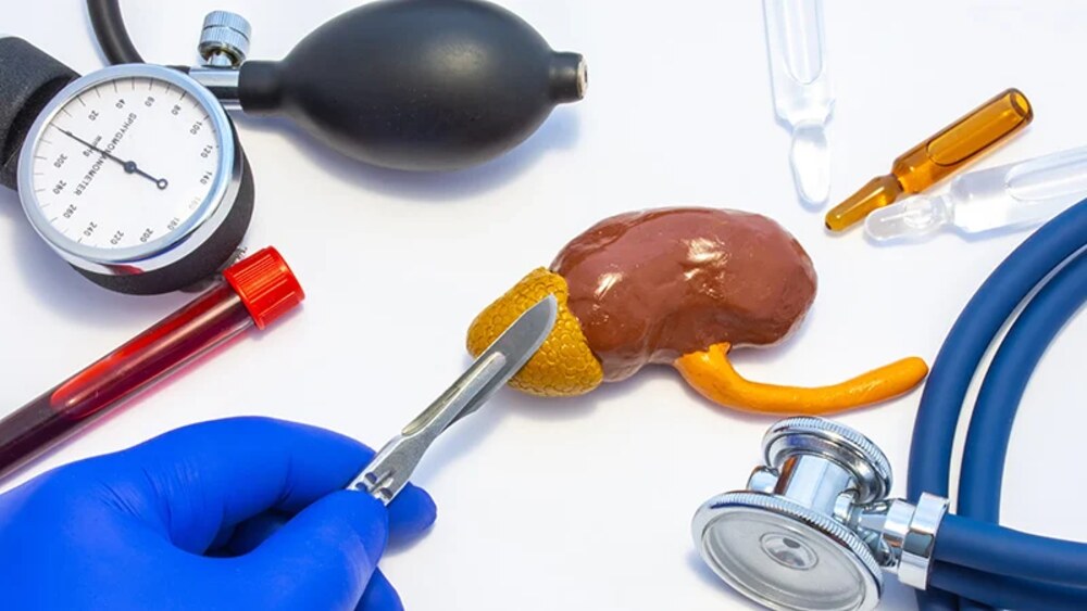 Illustration of an adrenalectomy procedure to remove adrenal tumors or treat hormone-producing adrenal disorders