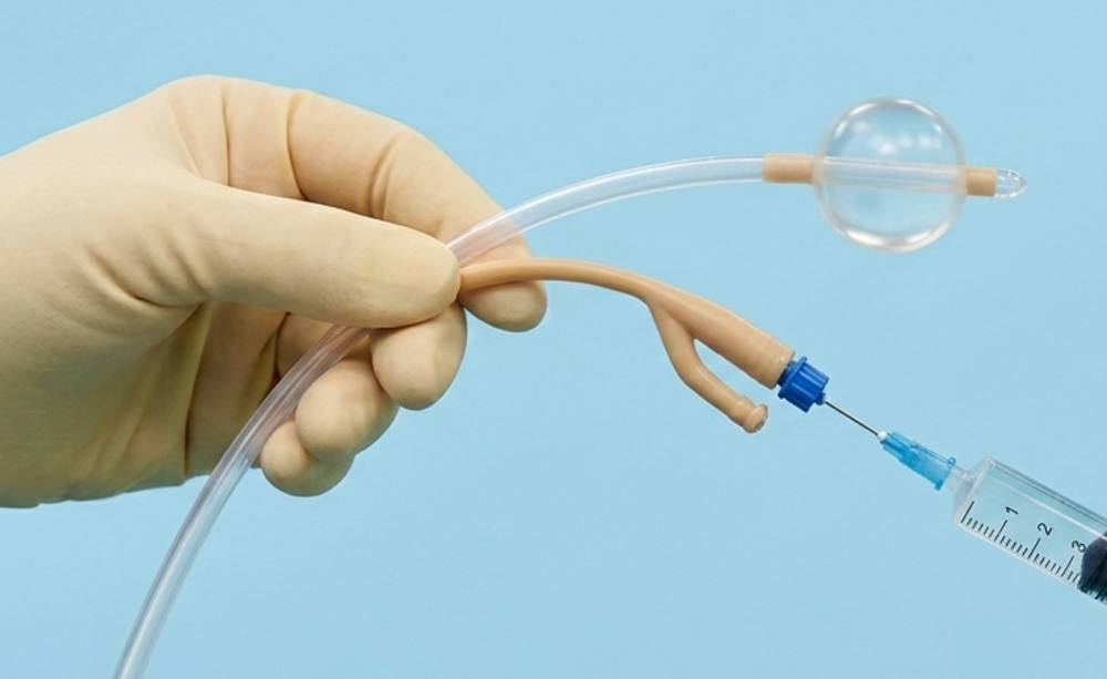 Medical syringe inflating a Word catheter balloon during a Bartholin's cyst treatment procedure to help drain the cyst