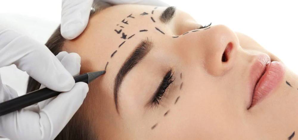Female patient undergoing brow lift surgery in an operating room