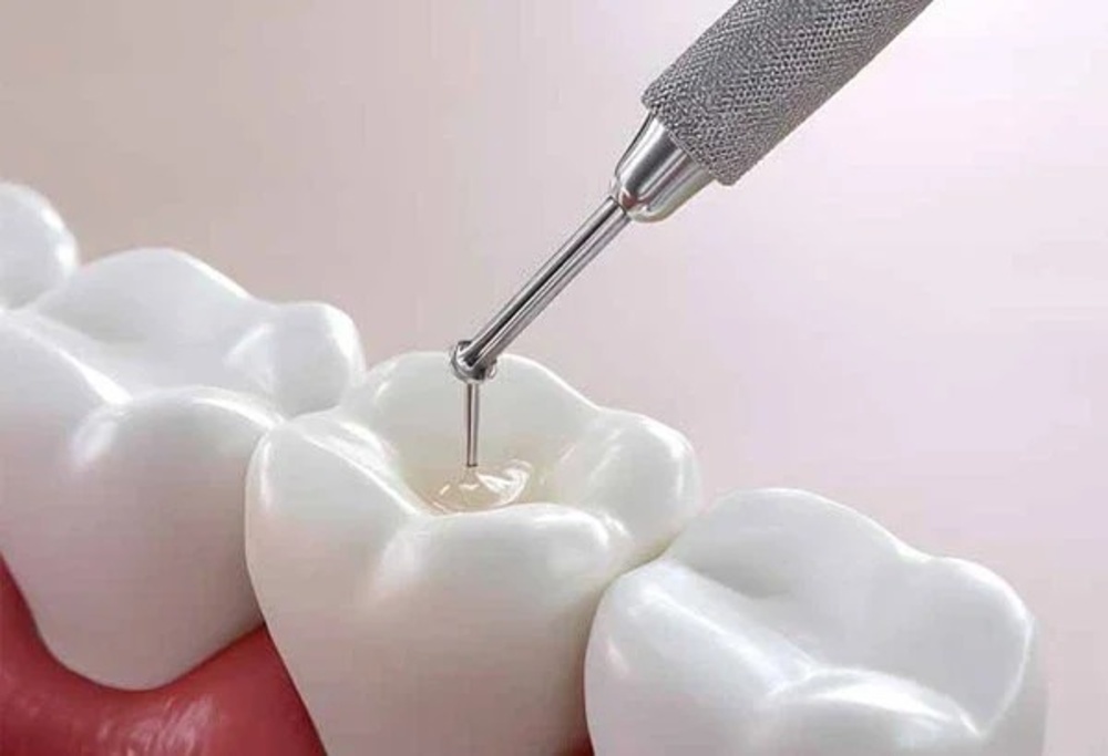 دانتوں کی خراب تہہ دوبارہ بنانے والا نیا جیل تیار