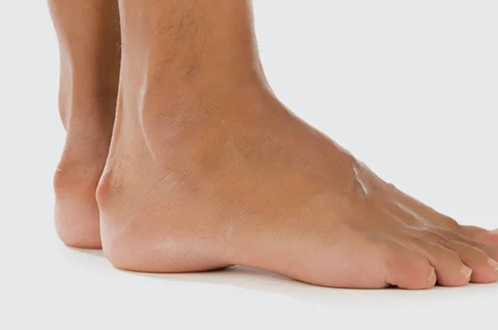 Bone Spurs