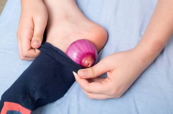 جرابوں میں پیاز رکھنے سے نزلہ زکام ٹھیک نہیں ہوتا، ماہرین