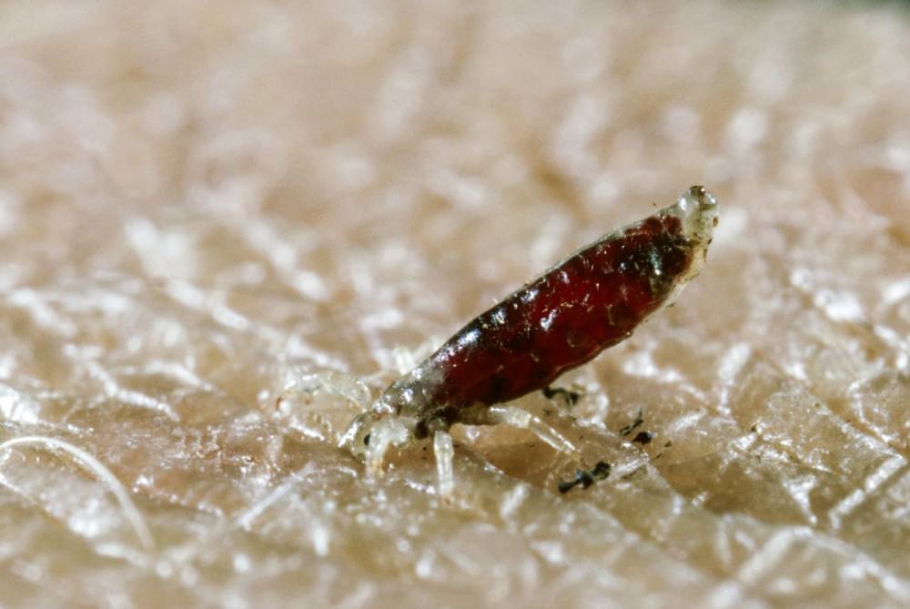 A medical close-up illustration of body lice crawling on clothing fibers beside a magnified view of a body louse, symbolizing body lice infestation and skin irritation.